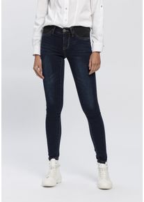Arizona Damen Skinny-fit-Jeans "Ultra Stretch", blau, modisch, Gr. 34, Denim/Jeans, Obermaterial: 63% Baumwolle, 32% Polyester, 5% Elasthan, Jeans,