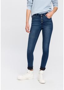 Arizona Damen Skinny-fit-Jeans "Ultra Stretch", blau, modisch, Gr. 36, Denim/Jeans, Obermaterial: 63% Baumwolle, 32% Polyester, 5% Elasthan, Jeans,