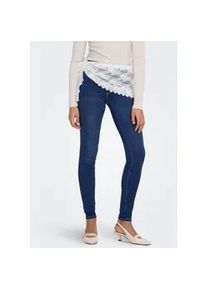 High-waist-Jeans Only "ONLROYAL", Damen, Gr. M (38), L&auml;nge 32, blau (dunkelblau denim), Denim/Jeans, Obermaterial: 69% Baumwolle, 29% Polyester, 2% Elasthan, Abriebeffekte, Jeans High-Waist-Jeans