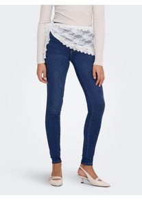 High-waist-Jeans Only "ONLROYAL", Damen, Gr. XL (42), L&auml;nge 32, blau (dunkelblau denim), Denim/Jeans, Obermaterial: 69% Baumwolle, 29% Polyester, 2% Elasthan, Abriebeffekte, Jeans High-waist-Jeans